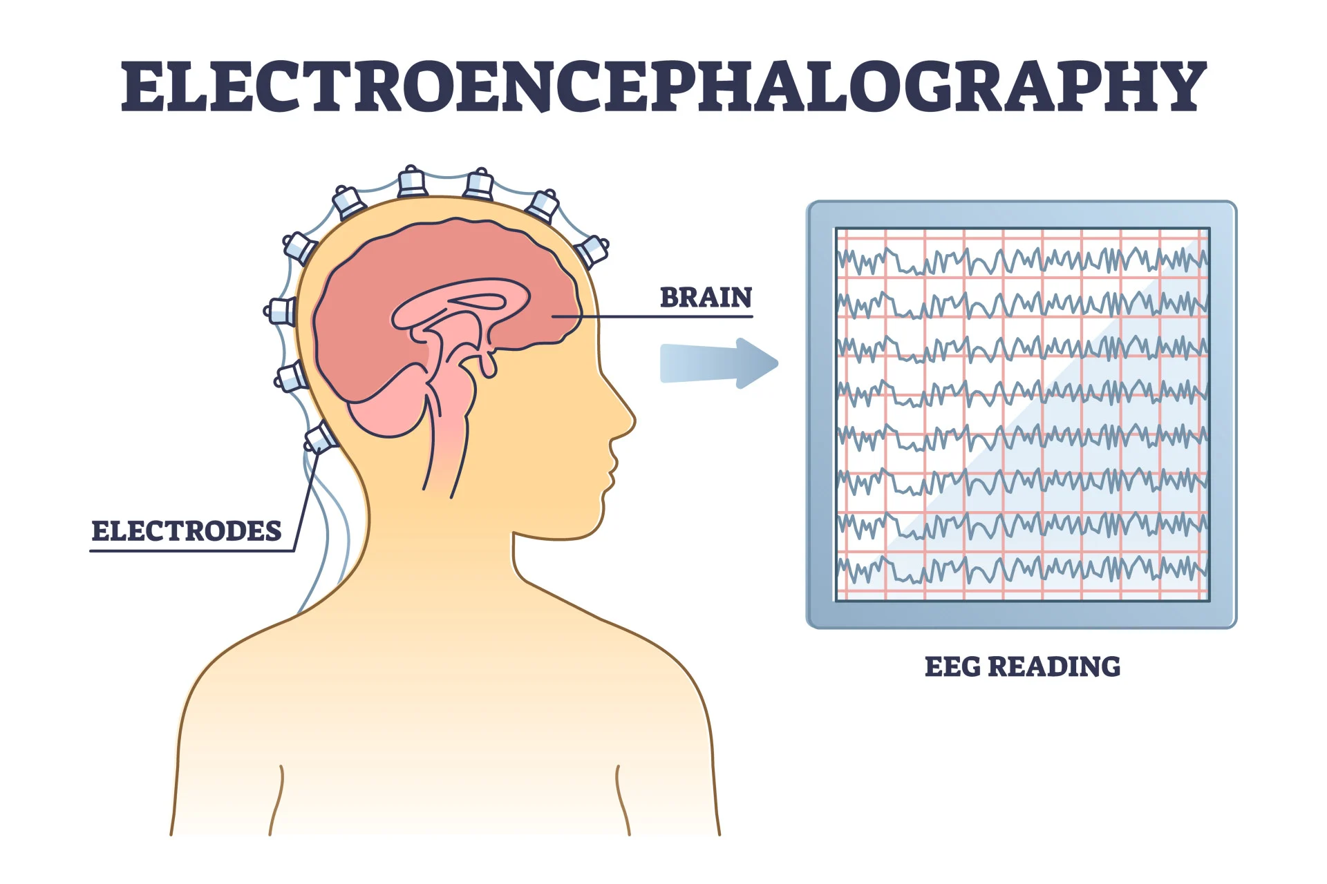 EEG Signal Analysis